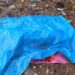 Gbessia : un enfant de 12 ans meurt après une chute dans une excavation